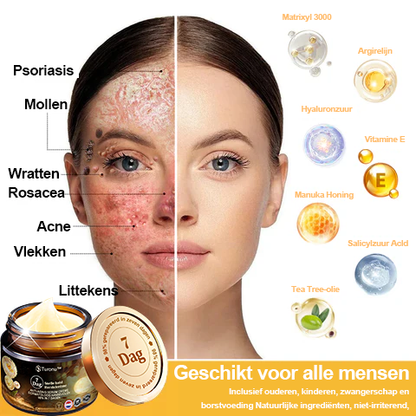Turonu™ 7-daagse multi-effect alles-in-één huidverzorgingscrème (aanbevolen door de Nederlandse Vereniging voor Dermatologie en Venereologie - NVDV)👨‍⚕️⭐