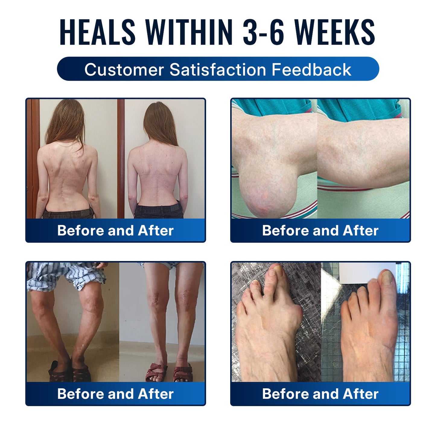 🎁Healrize® Bee Venom Joint Relief Cream 💞Fast-Acting Comfort for Stiff Knees, Hands, Back & Everyday Joint Discomfort