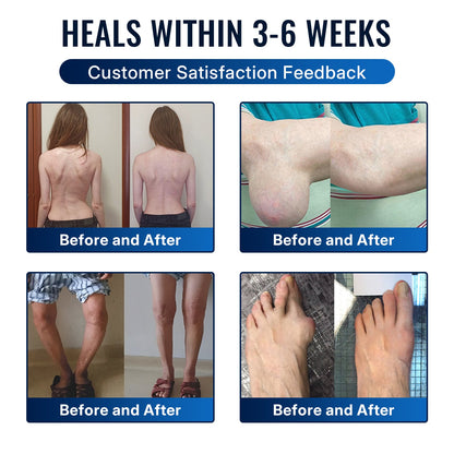 🎁Healrize® Bee Venom Joint Relief Cream 💞Fast-Acting Comfort for Stiff Knees, Hands, Back & Everyday Joint Discomfort