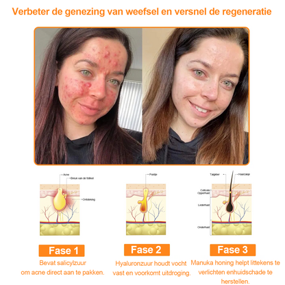 Turonu™ 7-daagse multi-effect alles-in-één huidverzorgingscrème (aanbevolen door de Nederlandse Vereniging voor Dermatologie en Venereologie - NVDV)👨‍⚕️⭐