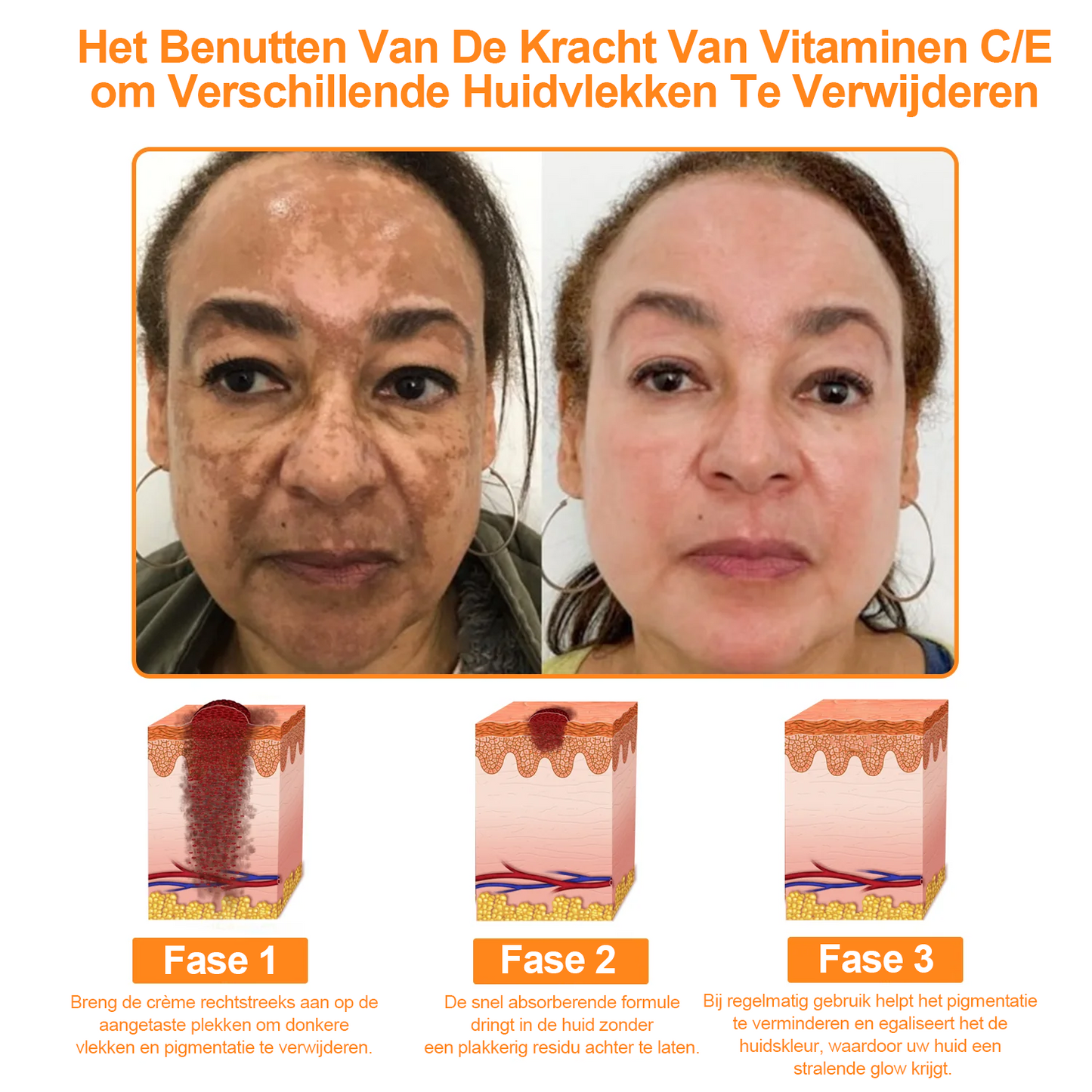 Turonu™ 7-daagse multi-effect alles-in-één huidverzorgingscrème (aanbevolen door de Nederlandse Vereniging voor Dermatologie en Venereologie - NVDV)👨‍⚕️⭐