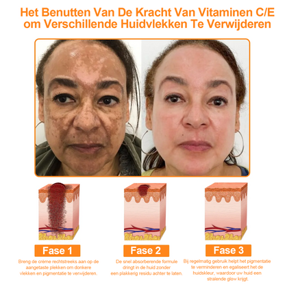 Turonu™ 7-daagse multi-effect alles-in-één huidverzorgingscrème (aanbevolen door de Nederlandse Vereniging voor Dermatologie en Venereologie - NVDV)👨‍⚕️⭐